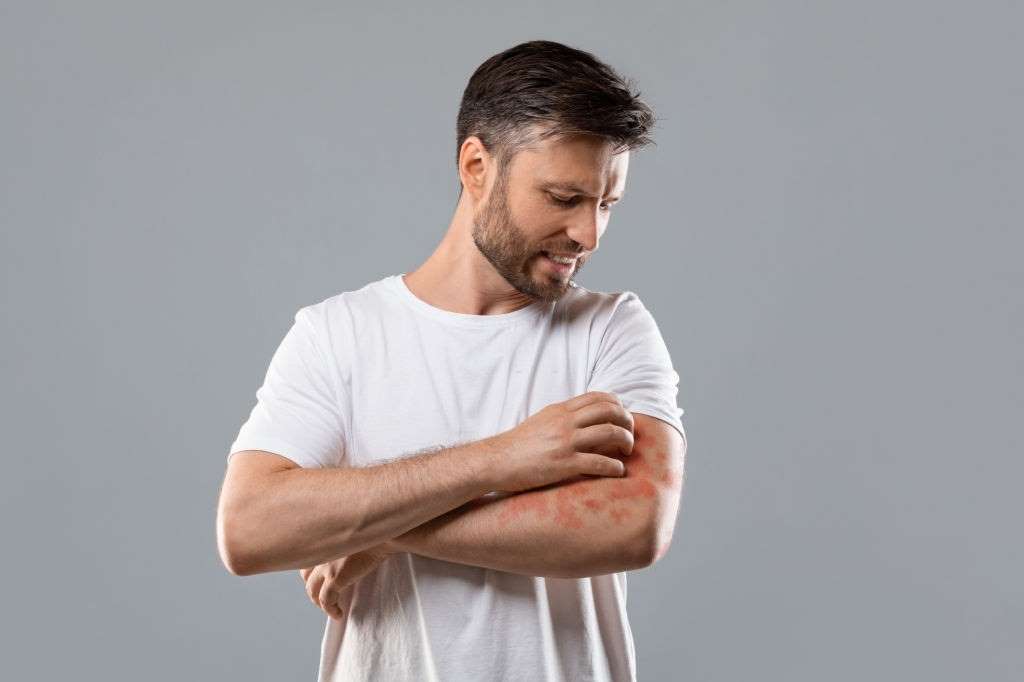 cbd for allergies